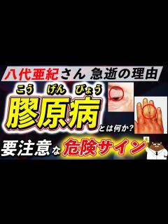 [x]放置厳禁！知らないと後悔する「膠原病」が引き起こす体の変化。なぜ八代亜紀さんは急逝したのか。初期の危険サインとは？医師が徹底解説！ - YouTube