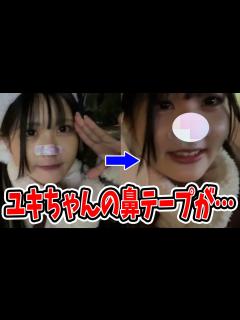 [x]ユキちゃんの鼻が…【ニコ生】 - YouTube