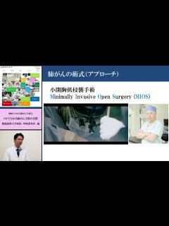 [x]3分で分かる肺癌手術の実際 - YouTube